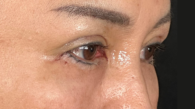 Postoperative Condition Part 1