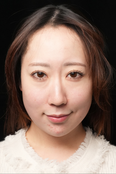 手术前的状态 其一