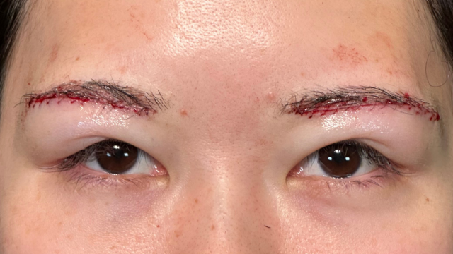 Postoperative Condition Part 1