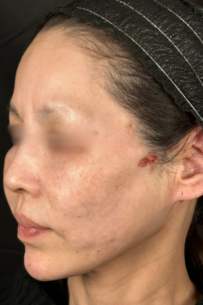 手術前の状態 その1