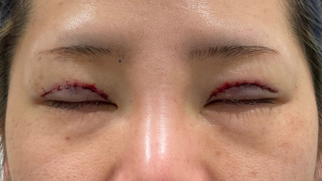 手術前の状態 その1