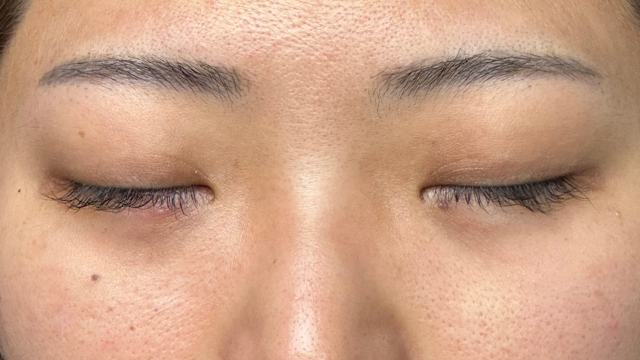 Postoperative Condition Part 1