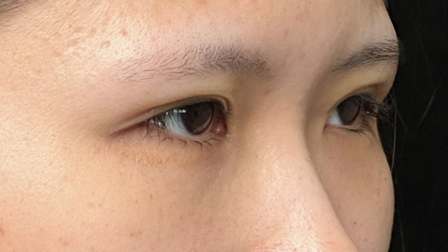 Postoperative Condition Part 1