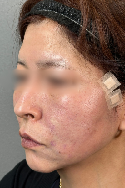 手術前の状態 その1