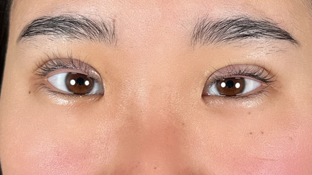 手术前的状态 其一