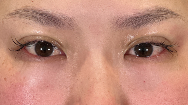 手术前的状态 其一