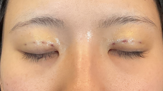 手术前的状态 其一