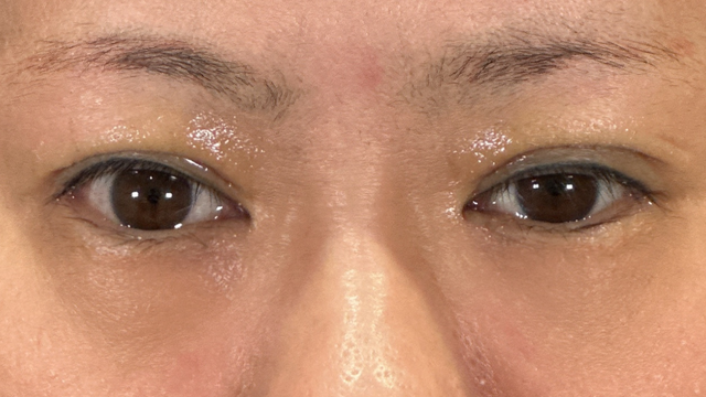 Postoperative Condition Part 1