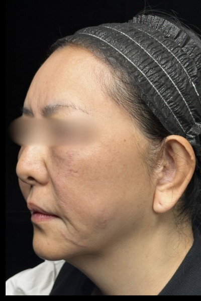 手術前の状態 その1