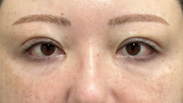 手术前的状态 其一