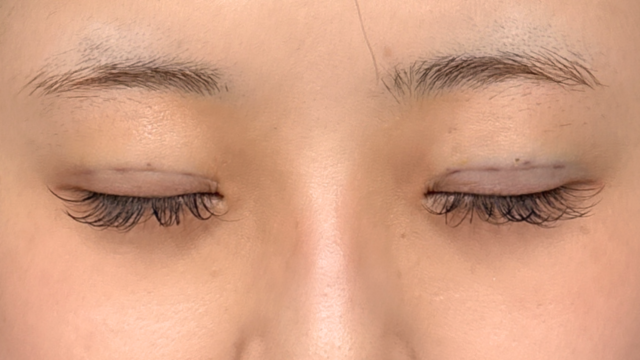 手术前的状态 其一