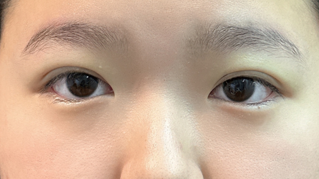 手术前的状态 其一