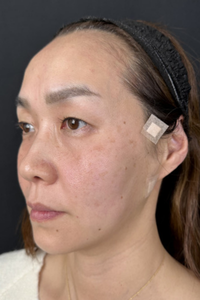 手术前的状态 其一