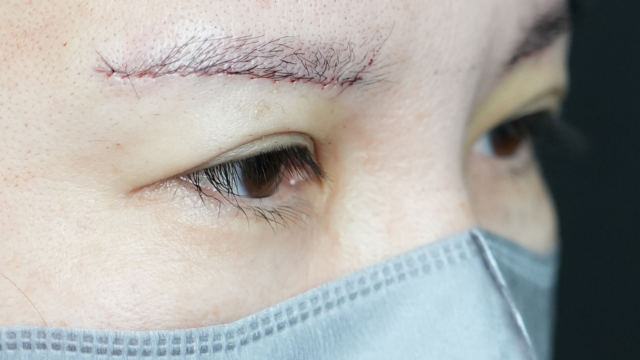 Postoperative Condition Part 1