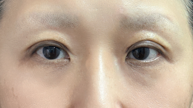 Postoperative Condition Part 1