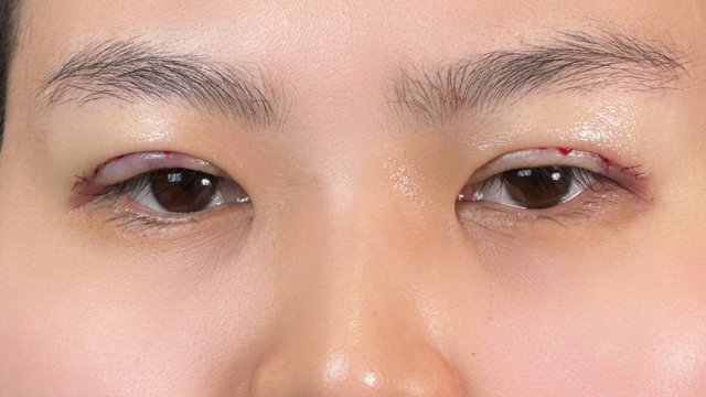 手术前的状态 其一