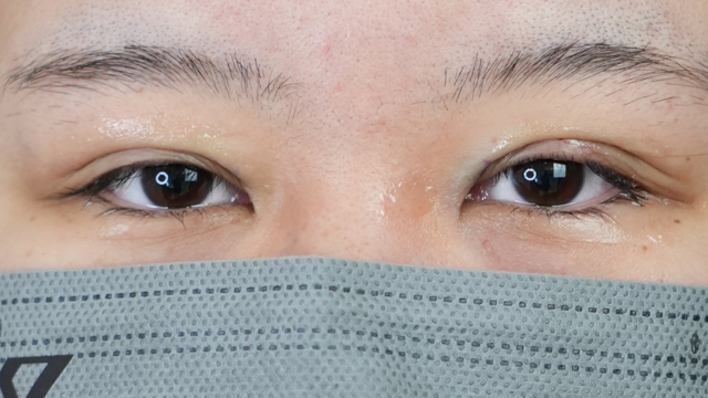 手术前的状态 其一