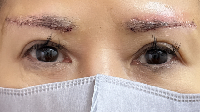 Postoperative Condition Part 1