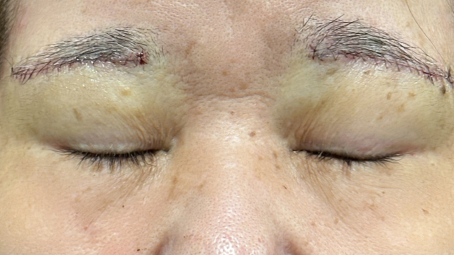 手术前的状态 其一