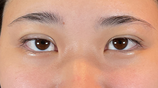 手術前の状態 その1