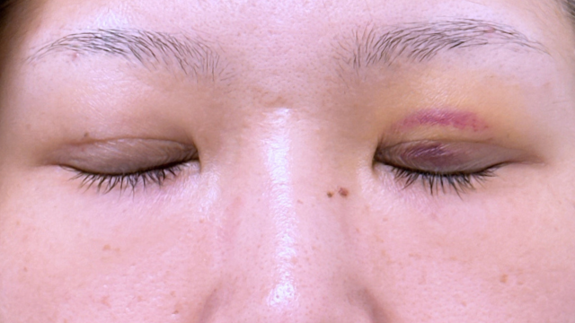 Postoperative Condition Part 1