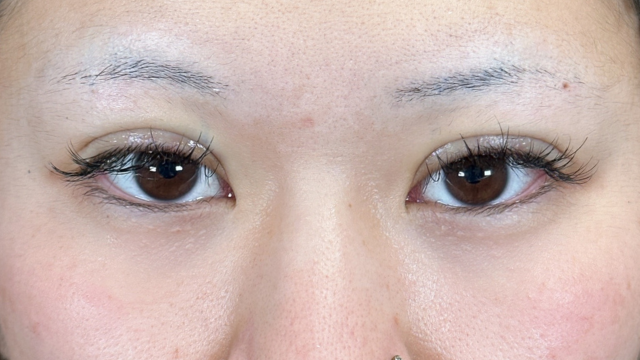 手术前的状态 其一