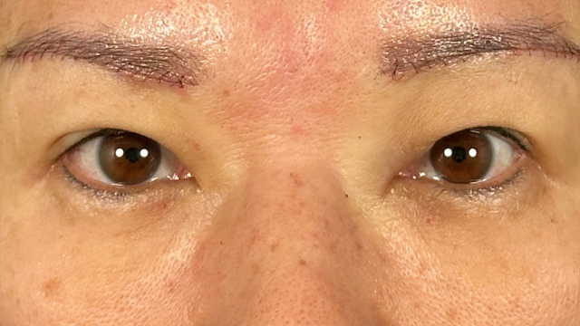 Postoperative Condition Part 1