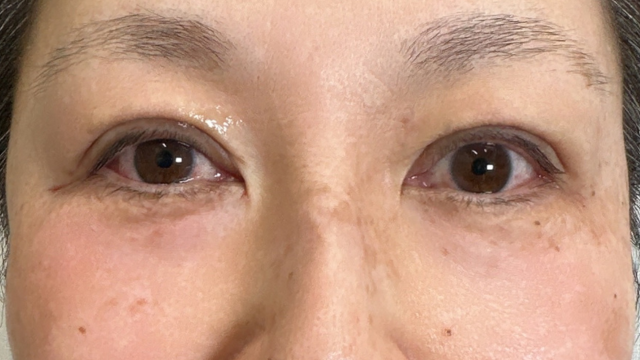 手术前的状态 其一