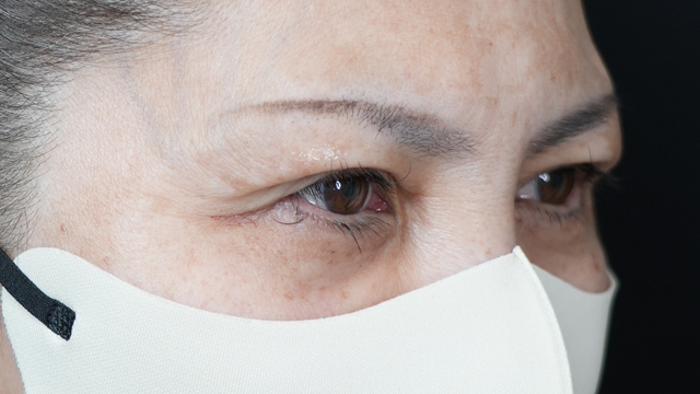 手术前的状态 其一