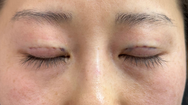 手术前的状态 其一