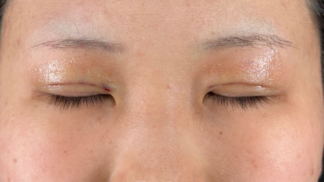 手术前的状态 其一