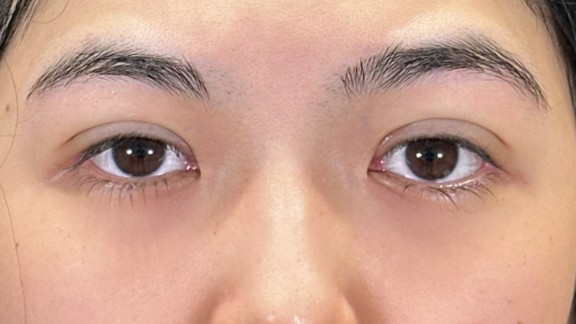 手术前的状态 其一