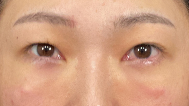 Postoperative Condition Part 1