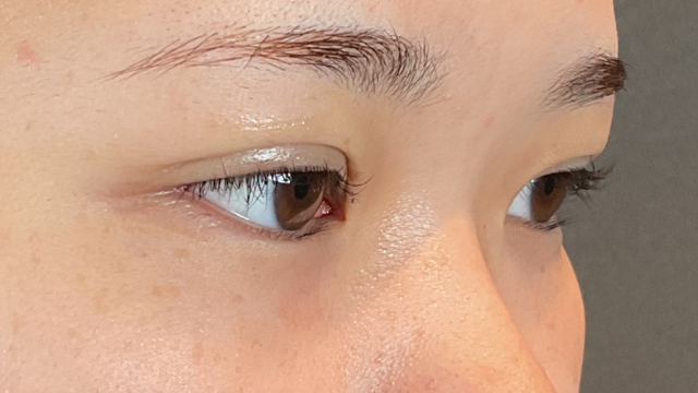 手術前の状態 その1