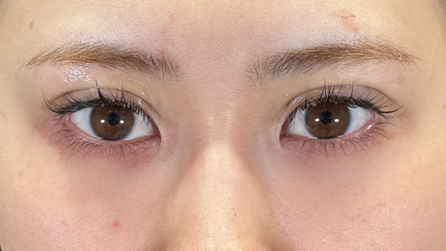 手术前的状态 其一