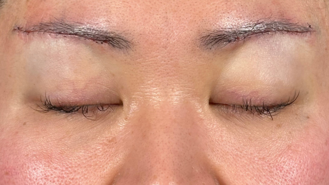 Postoperative Condition Part 1