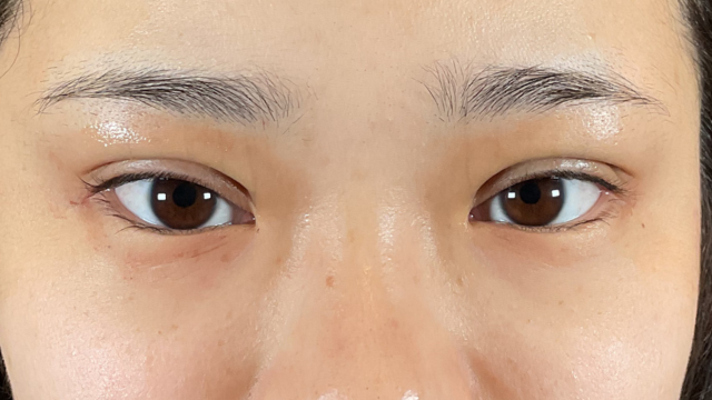 手术前的状态 其一