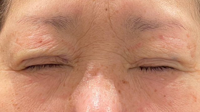 手术前的状态 其一