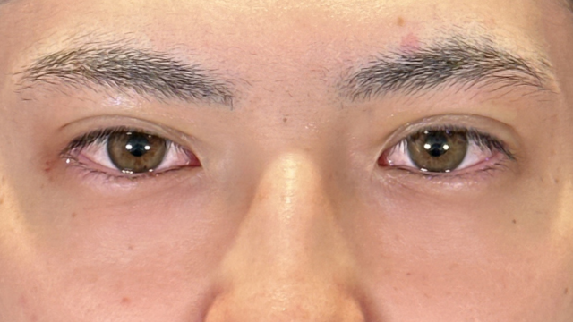 Postoperative Condition Part 1