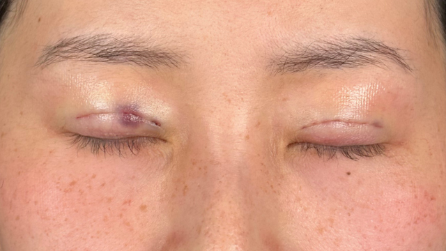 手术前的状态 其一