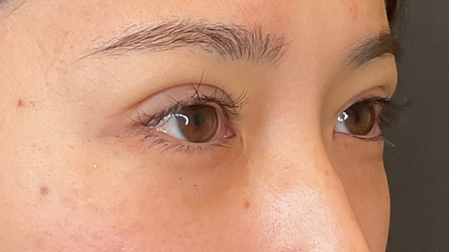 手术前的状态 其一