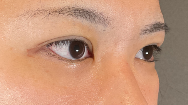 手术前的状态 其一