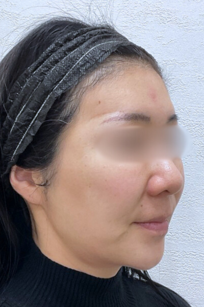 手術前の状態 その1