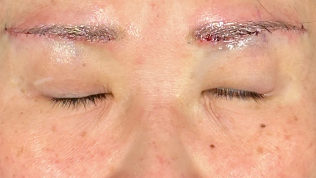 手术前的状态 其一