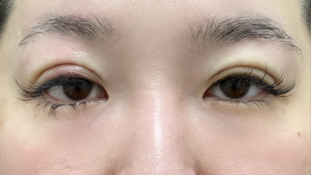 Postoperative Condition Part 1