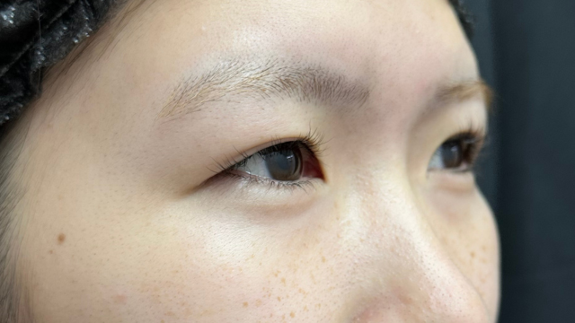 手术前的状态 其一