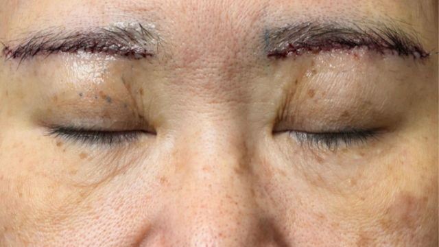 Postoperative Condition Part 1