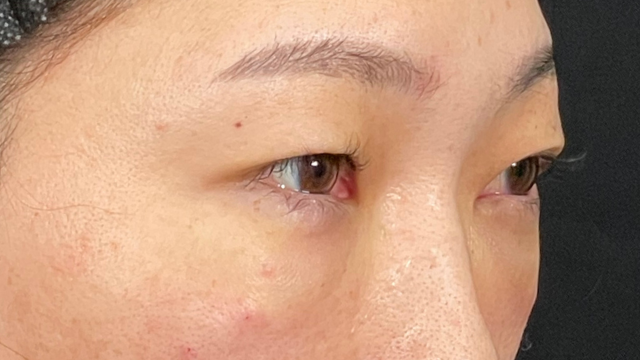 Postoperative Condition Part 1