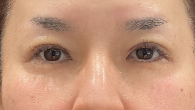 手术前的状态 其一