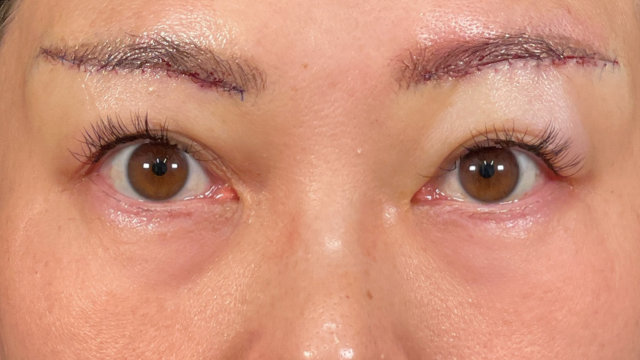 Postoperative Condition Part 1